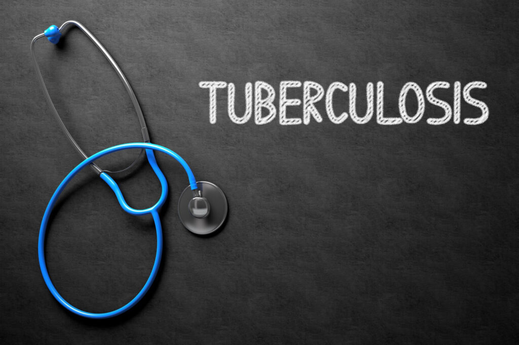 ¿Es posible poner fin a la tuberculosis?